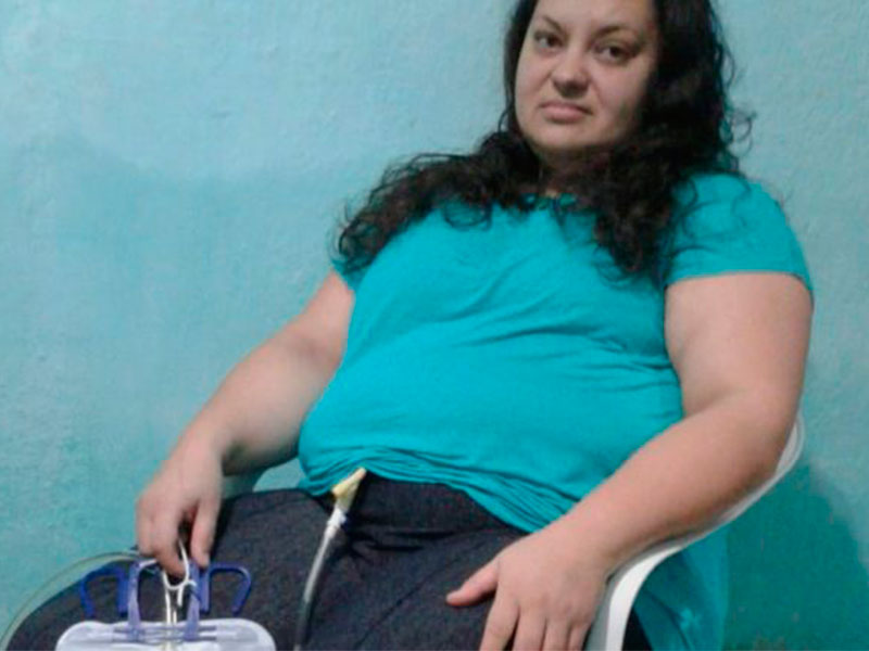 Canguçuense busca ajuda financeira para realizar cirurgia na coluna