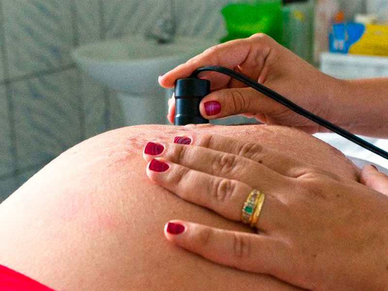 Sancionada lei que reduz idade mínima para laqueadura