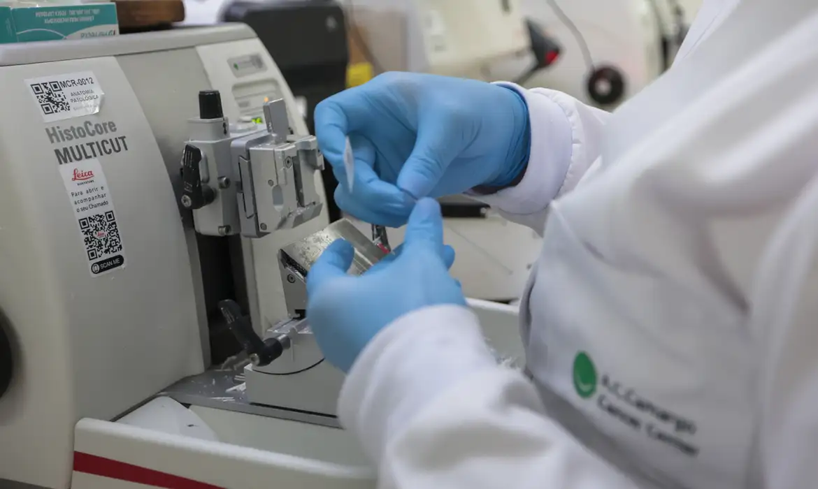 SUS passa a oferecer nova terapia para tratamento da leucemia mieloide aguda